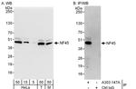 NF45 Antibody in Western Blot (WB)