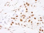 NF90 Antibody in Immunohistochemistry (IHC)