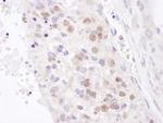 NF90/NF110 Antibody in Immunohistochemistry (IHC)