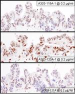 NF90/NF110 Antibody in Immunohistochemistry (IHC)