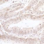 NFAT3 Antibody in Immunohistochemistry (IHC)