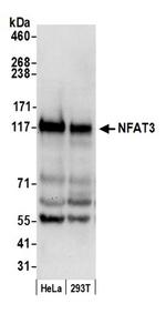 NFAT3 Antibody in Western Blot (WB)