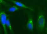 NFKBIA Antibody in Immunocytochemistry (ICC/IF)