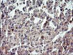 NFKBIA Antibody in Immunohistochemistry (Paraffin) (IHC (P))