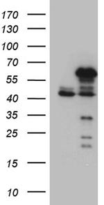 NFKBIE Antibody in Western Blot (WB)