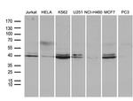 NFKBIE Antibody in Western Blot (WB)