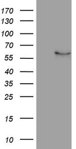 NFKBIE Antibody in Western Blot (WB)