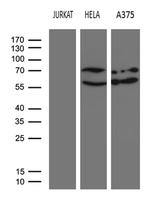 NFKBIE Antibody in Western Blot (WB)