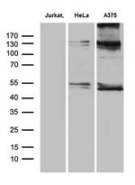 NFKBIE Antibody in Western Blot (WB)