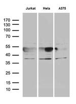 NFKBIE Antibody in Western Blot (WB)