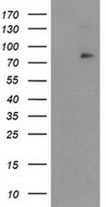NFKBIZ Antibody in Western Blot (WB)
