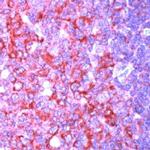 NFkB p50/p105 Antibody in Immunohistochemistry (IHC)