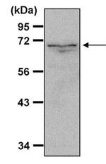 NFkB p65 Antibody in Western Blot (WB)