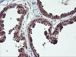 NHEJ1 Antibody in Immunohistochemistry (Paraffin) (IHC (P))