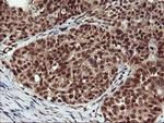 NHEJ1 Antibody in Immunohistochemistry (Paraffin) (IHC (P))