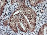 NHEJ1 Antibody in Immunohistochemistry (Paraffin) (IHC (P))