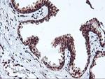 NHEJ1 Antibody in Immunohistochemistry (Paraffin) (IHC (P))