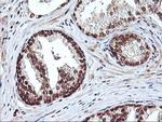 NHEJ1 Antibody in Immunohistochemistry (Paraffin) (IHC (P))