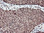 NHEJ1 Antibody in Immunohistochemistry (Paraffin) (IHC (P))