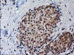 NHEJ1 Antibody in Immunohistochemistry (Paraffin) (IHC (P))