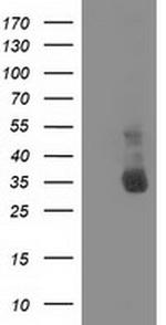 NHEJ1 Antibody in Western Blot (WB)