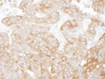 NHERF1 Antibody in Immunohistochemistry (IHC)