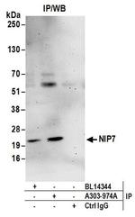 NIP7 Antibody in Western Blot (WB)