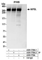 NIPBL Antibody in Immunoprecipitation (IP)