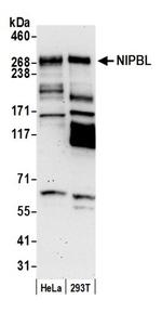 NIPBL Antibody in Western Blot (WB)