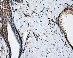 NIT2 Antibody in Immunohistochemistry (Paraffin) (IHC (P))