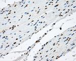 NIT2 Antibody in Immunohistochemistry (Paraffin) (IHC (P))