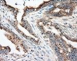 NIT2 Antibody in Immunohistochemistry (Paraffin) (IHC (P))