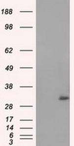 NIT2 Antibody in Western Blot (WB)