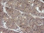 NKIRAS1 Antibody in Immunohistochemistry (Paraffin) (IHC (P))