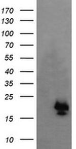 NKIRAS1 Antibody in Western Blot (WB)