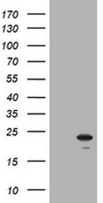 NKIRAS1 Antibody in Western Blot (WB)