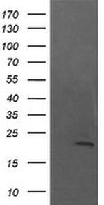 NKIRAS1 Antibody in Western Blot (WB)