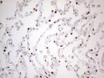 NKX2 Antibody in Immunohistochemistry (Paraffin) (IHC (P))