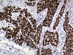 NKX2 Antibody in Immunohistochemistry (Paraffin) (IHC (P))