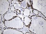 NKX2 Antibody in Immunohistochemistry (Paraffin) (IHC (P))