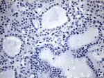 NKX2 Antibody in Immunohistochemistry (Paraffin) (IHC (P))