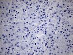 NKX2 Antibody in Immunohistochemistry (Paraffin) (IHC (P))