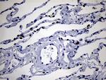 NKX2 Antibody in Immunohistochemistry (Paraffin) (IHC (P))