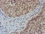 NLN Antibody in Immunohistochemistry (Paraffin) (IHC (P))