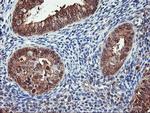 NLN Antibody in Immunohistochemistry (Paraffin) (IHC (P))