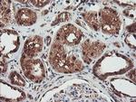 NLN Antibody in Immunohistochemistry (Paraffin) (IHC (P))