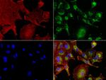 NME1 Antibody in Immunocytochemistry (ICC/IF)