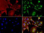 NME1 Antibody in Immunocytochemistry (ICC/IF)