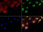 NME1 Antibody in Immunocytochemistry (ICC/IF)