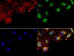 NME1 Antibody in Immunocytochemistry (ICC/IF)